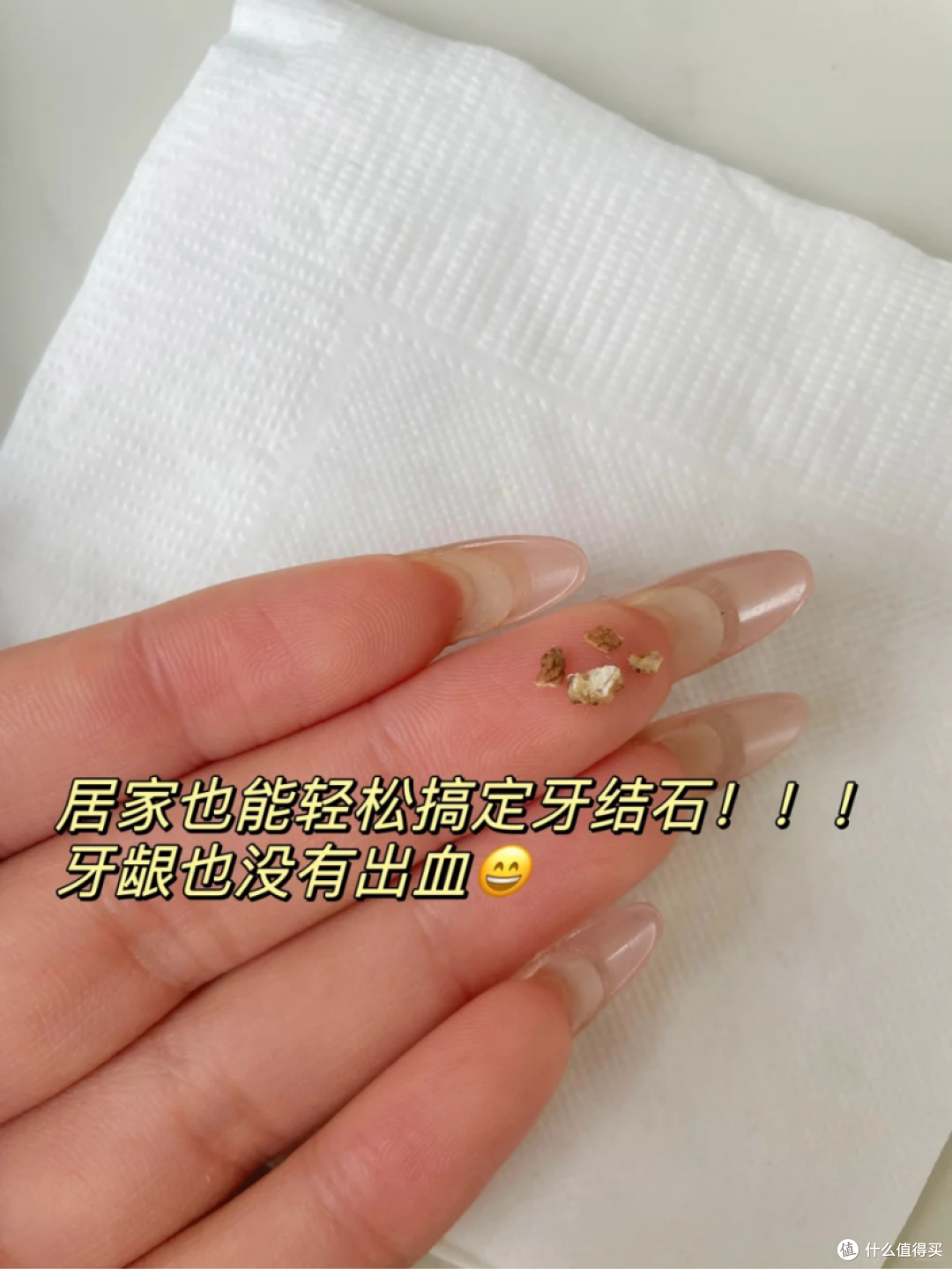 牙龈萎缩不但能好,而且很容易好!