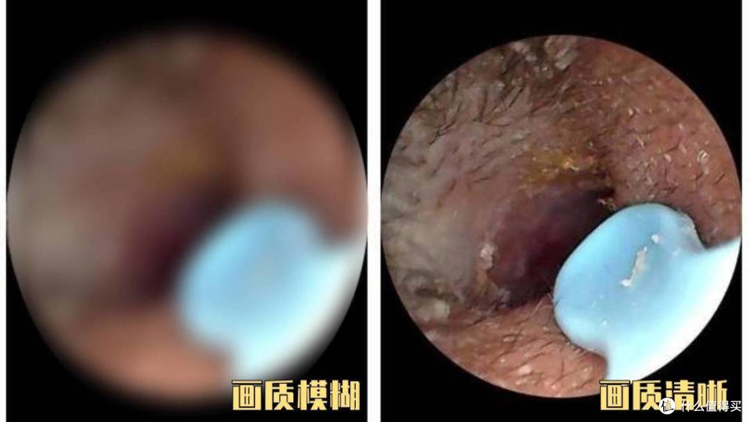 可视挖耳勺排名前十名品牌大汇总：哪个牌子好对比测评一目了然！