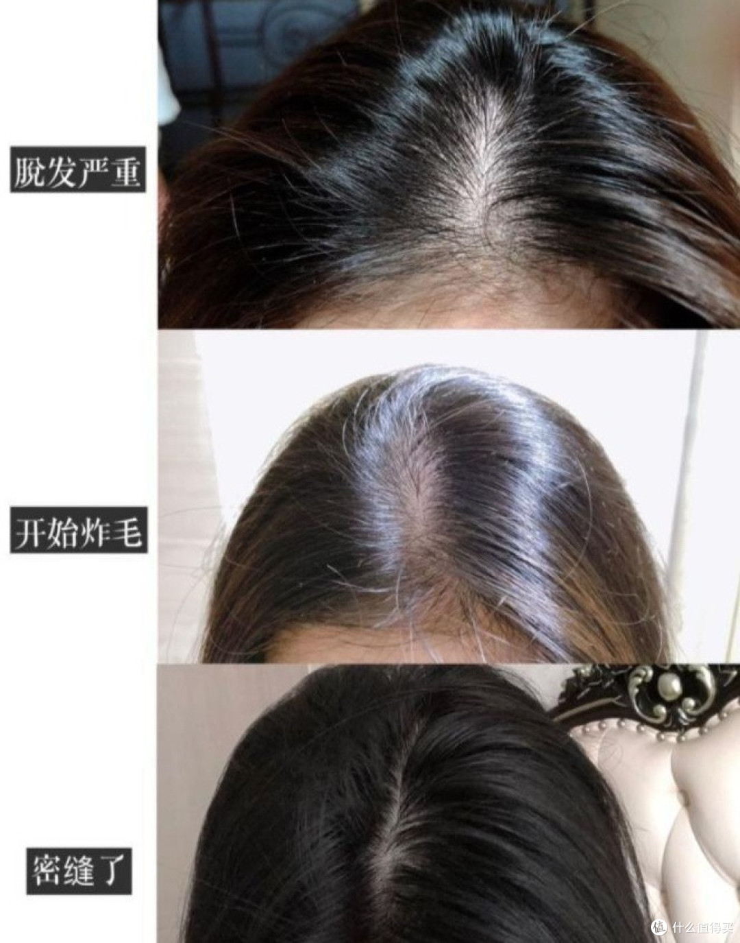 公认有效防脱生发,正规防脱产品前十,养发稳了!