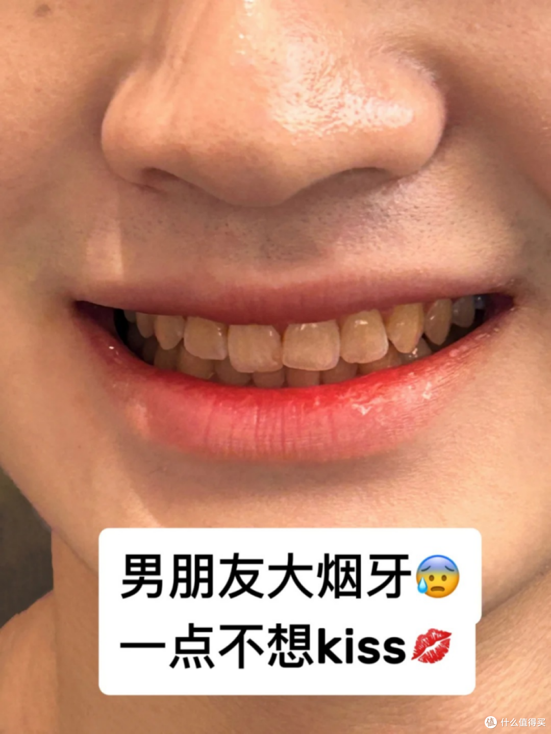 对象的烟渍牙总算是有救了!!成本不到30,牙黄试试这个方法!