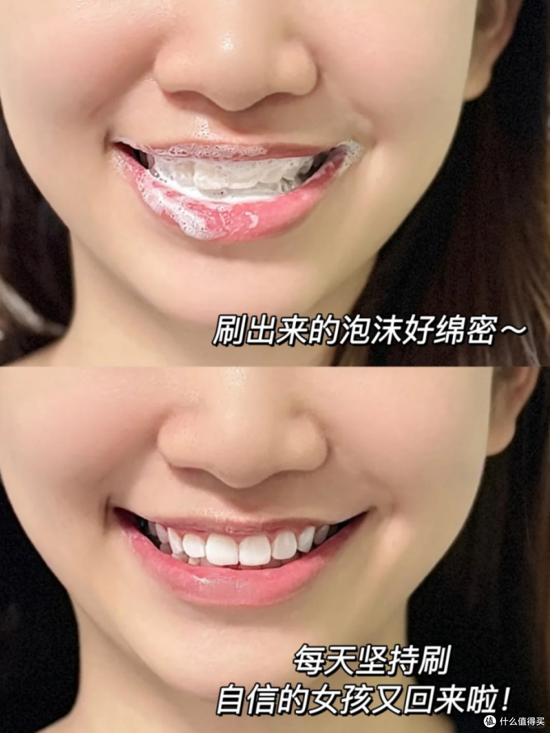 牙齿黄怎么办?这题我会!低成本白牙保姆攻略来咯~