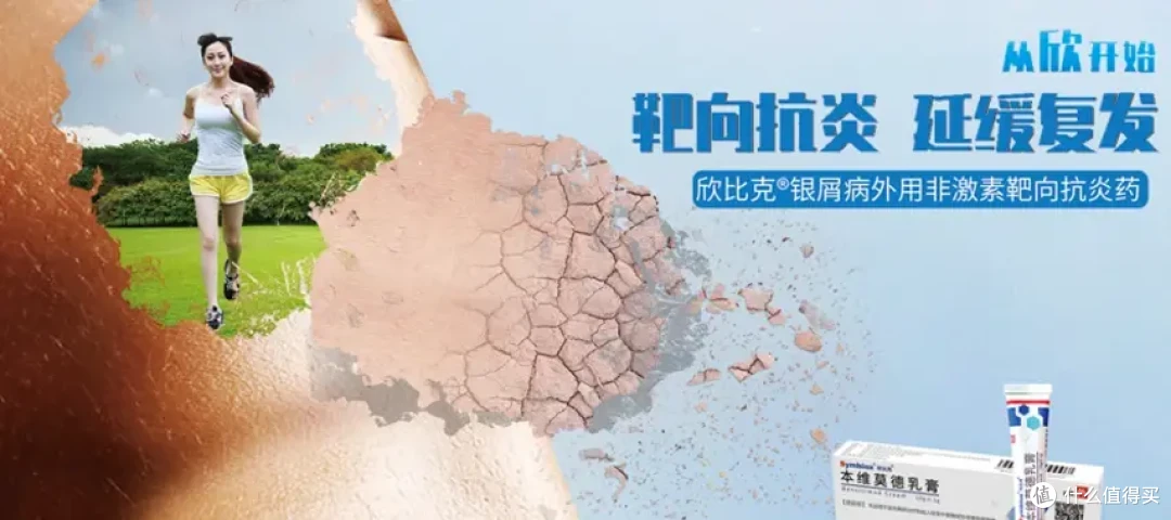银屑病冬重夏轻，如何把握如何好夏季银屑病治疗的“黄金期”？