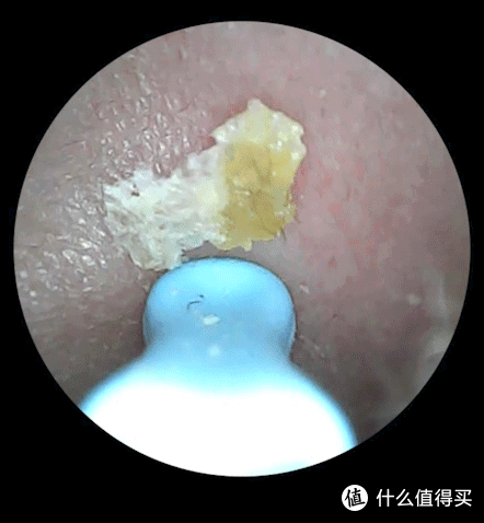 看得见才有安全感,蜂鸟bebird 3 Plus可视挖耳勺使用体验