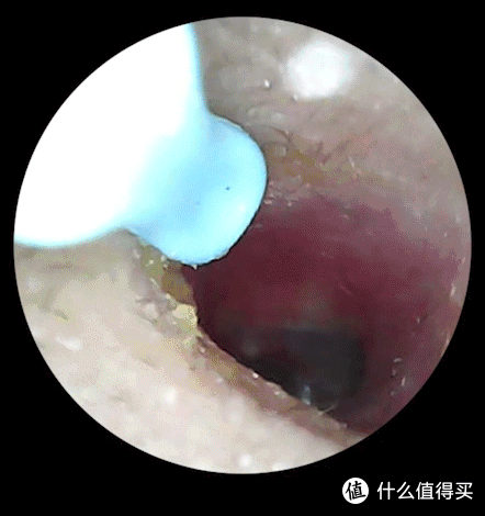 看得见才有安全感,蜂鸟bebird 3 Plus可视挖耳勺使用体验