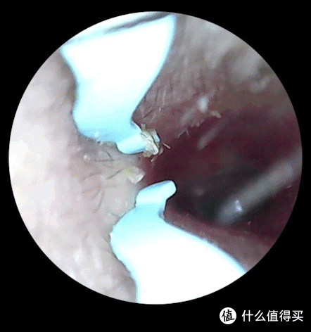 看得见才有安全感,蜂鸟bebird 3 Plus可视挖耳勺使用体验
