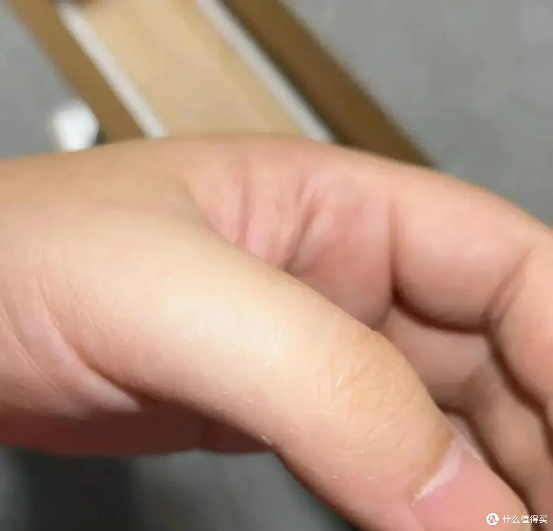 碰一下就刺痒难忍?这种“隐形杀手”就在你身边,家里有的快扔掉