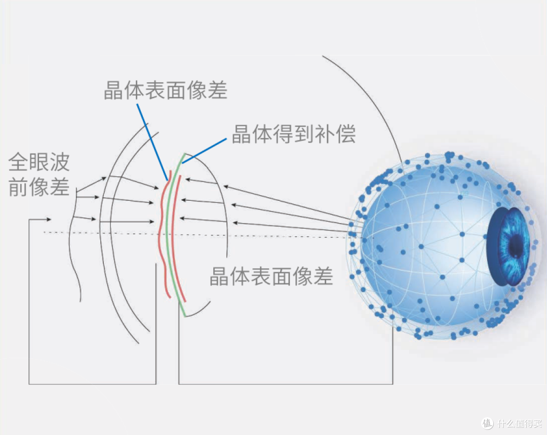 视力模糊的痛谁懂？定制角膜轮廓治疗为你排忧解难