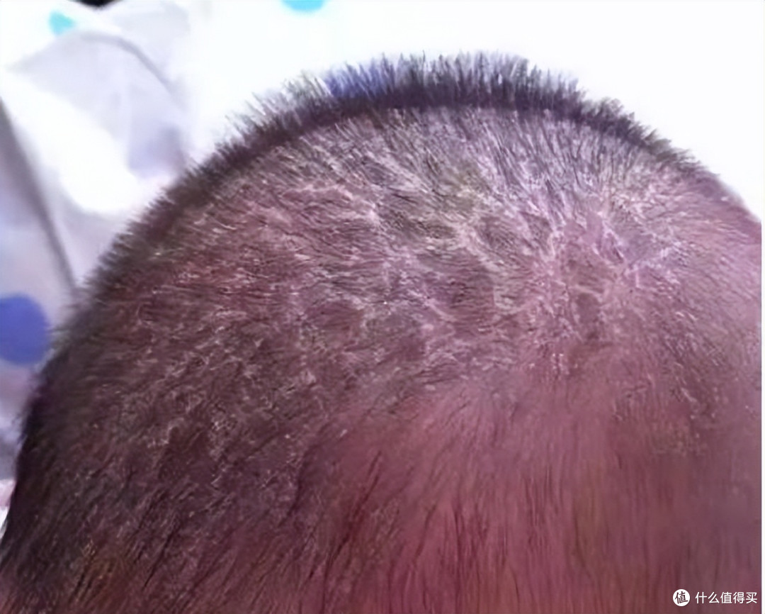 宝宝出生后,这6件事别对他做
