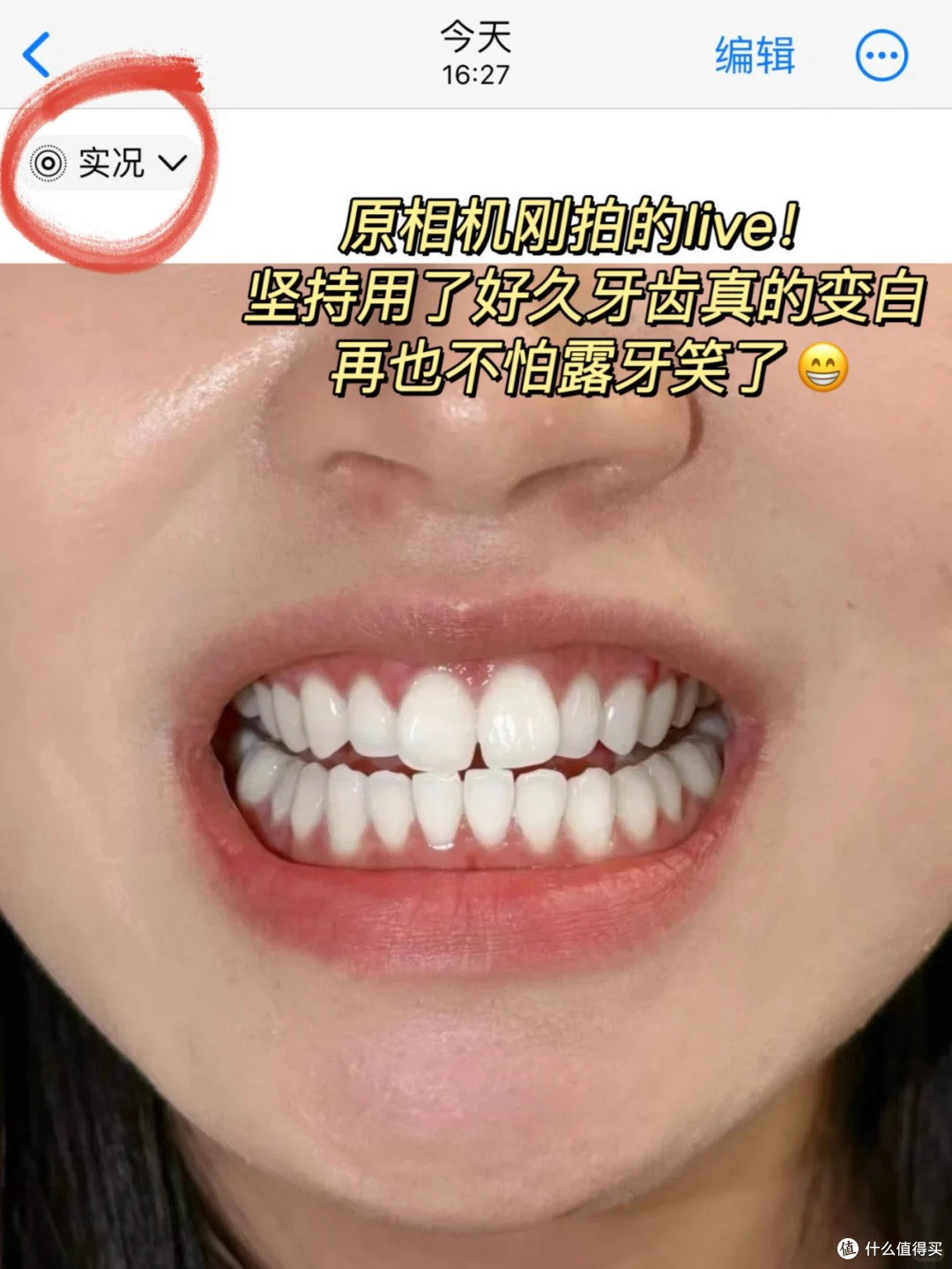 牙齿比较黄怎么办?好自卑,黄牙自救指南!