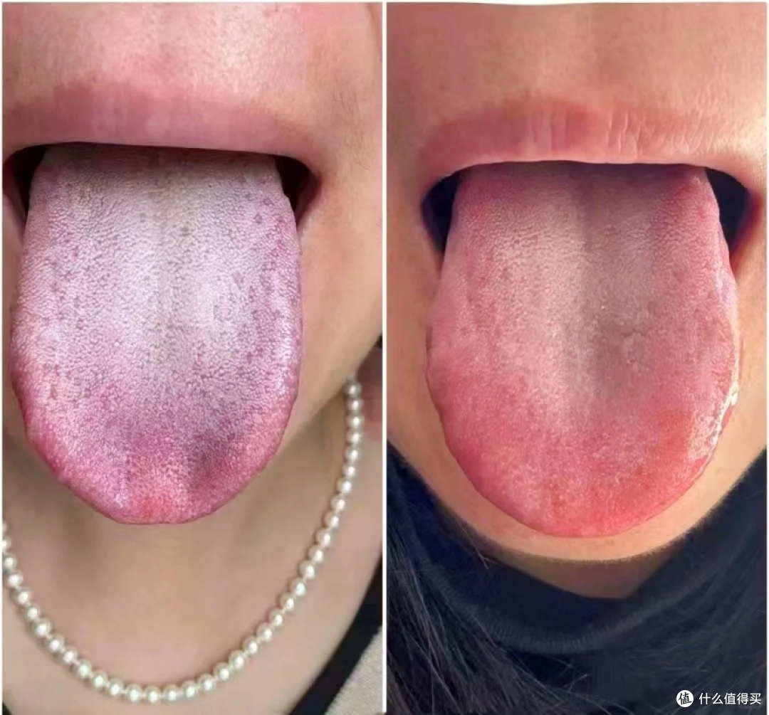 轻度脂肪肝?一个月自救,肝功能正常了!