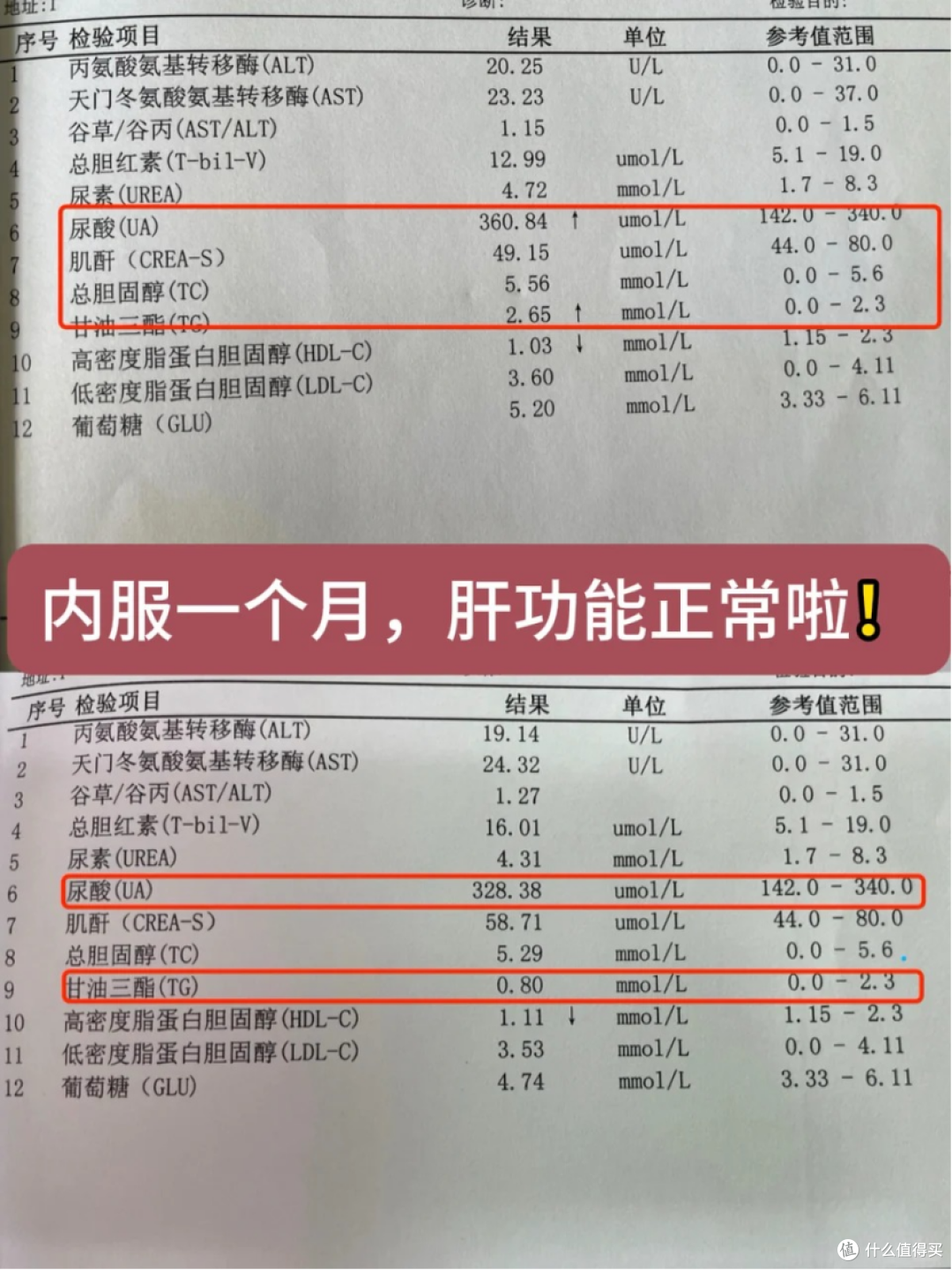轻度脂肪肝?一个月自救,肝功能正常了!