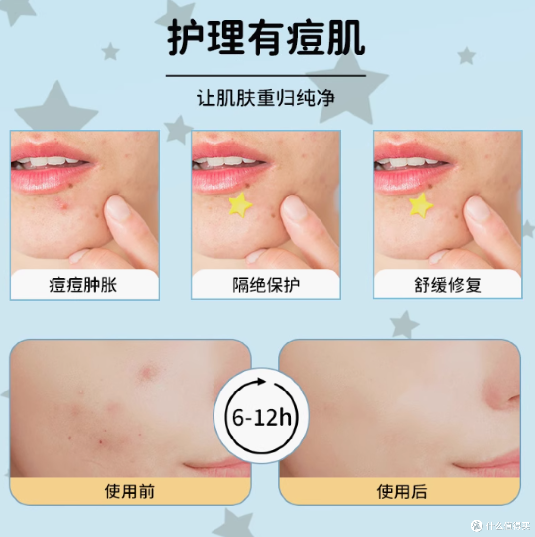 AUSLKA Beauty 60 贴星星痘痘贴:痘痘肌的贴心救星