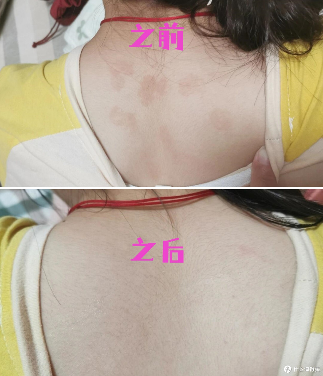 不要小瞧“2块钱的硫磺皂”，这惊人的“杀伤力”，我是彻底服了