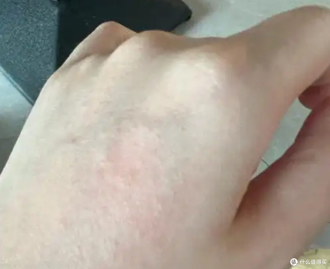 夏日亲测!物理防晒才是过敏星人的保命秘籍