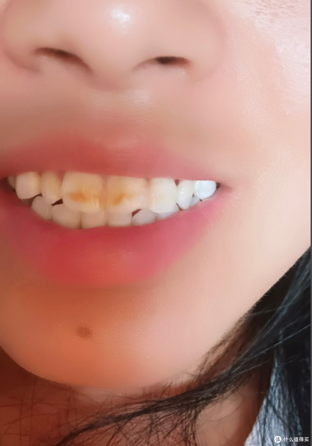 牙结石又黄又臭？折腾了两个月，我终于把它搞定了！