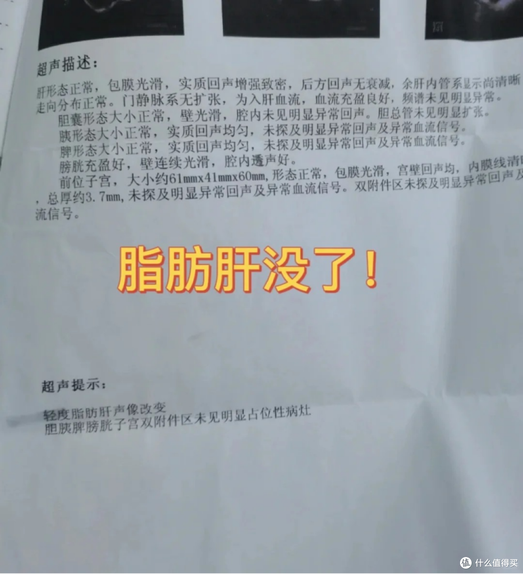 原来脂肪肝不是胖人专属!脂肪肝调养半年终于恢复!内调经验分享