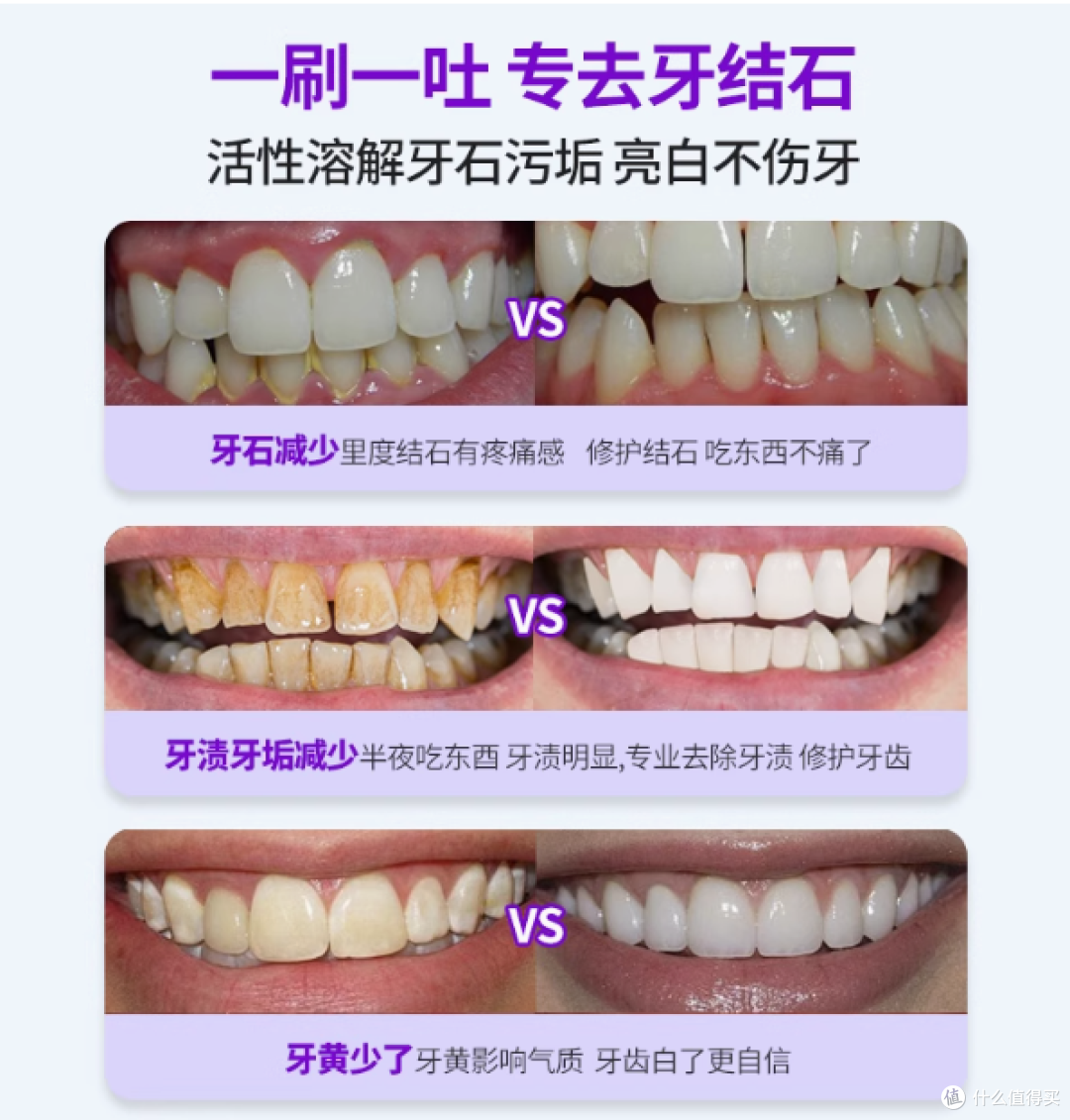 🦷一口大白牙的秘密!全靠它