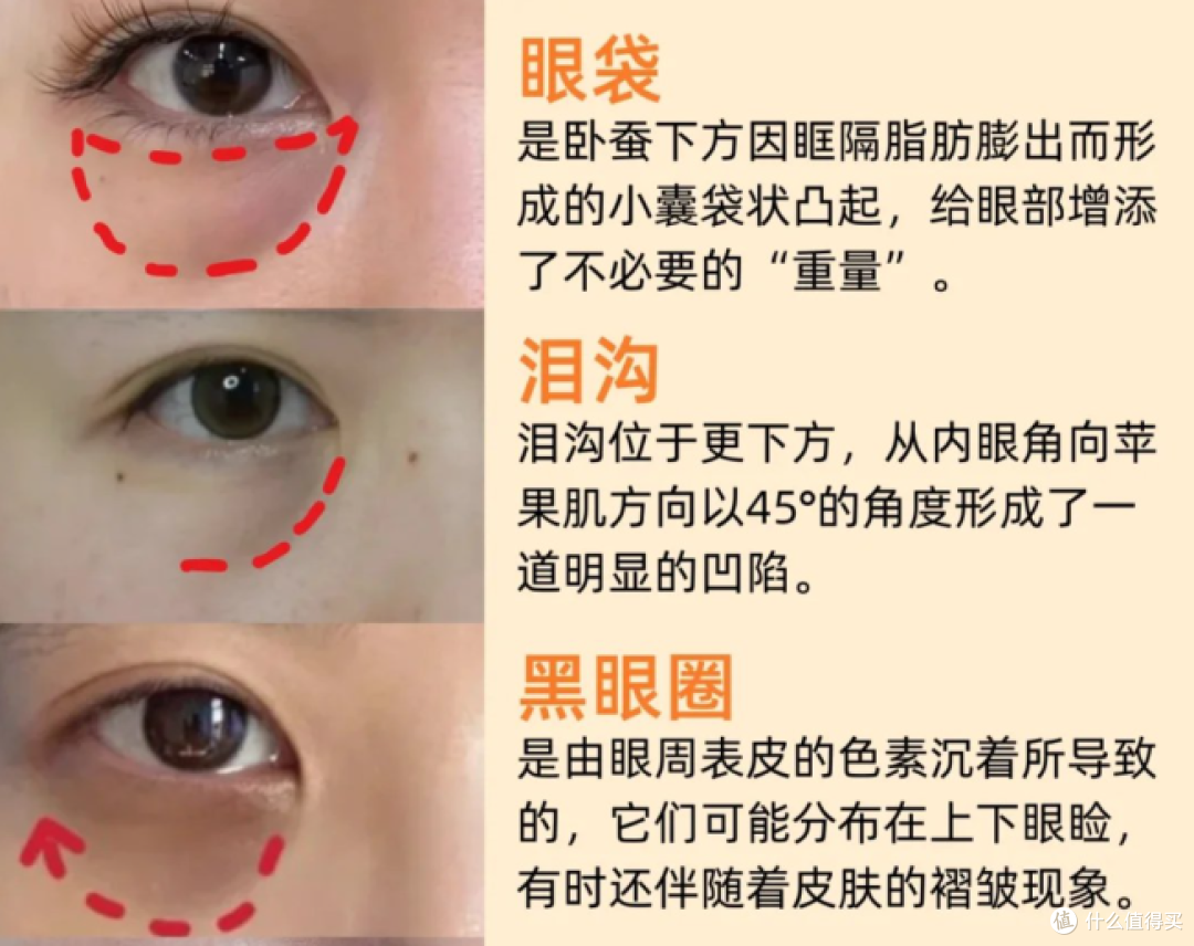 去黑眼圈眼霜副作用大不大？揭秘劣质产品的惊人危害！