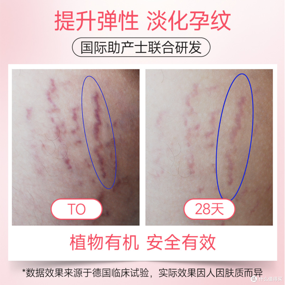 与纹和解｜维蕾德妊娠油的理性守护哲学
