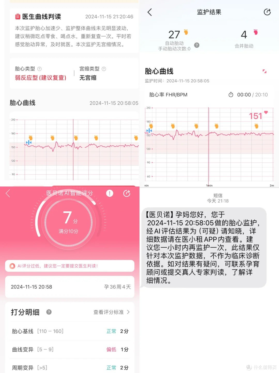 刚足月 宝宝胎动频繁，果然有问题…