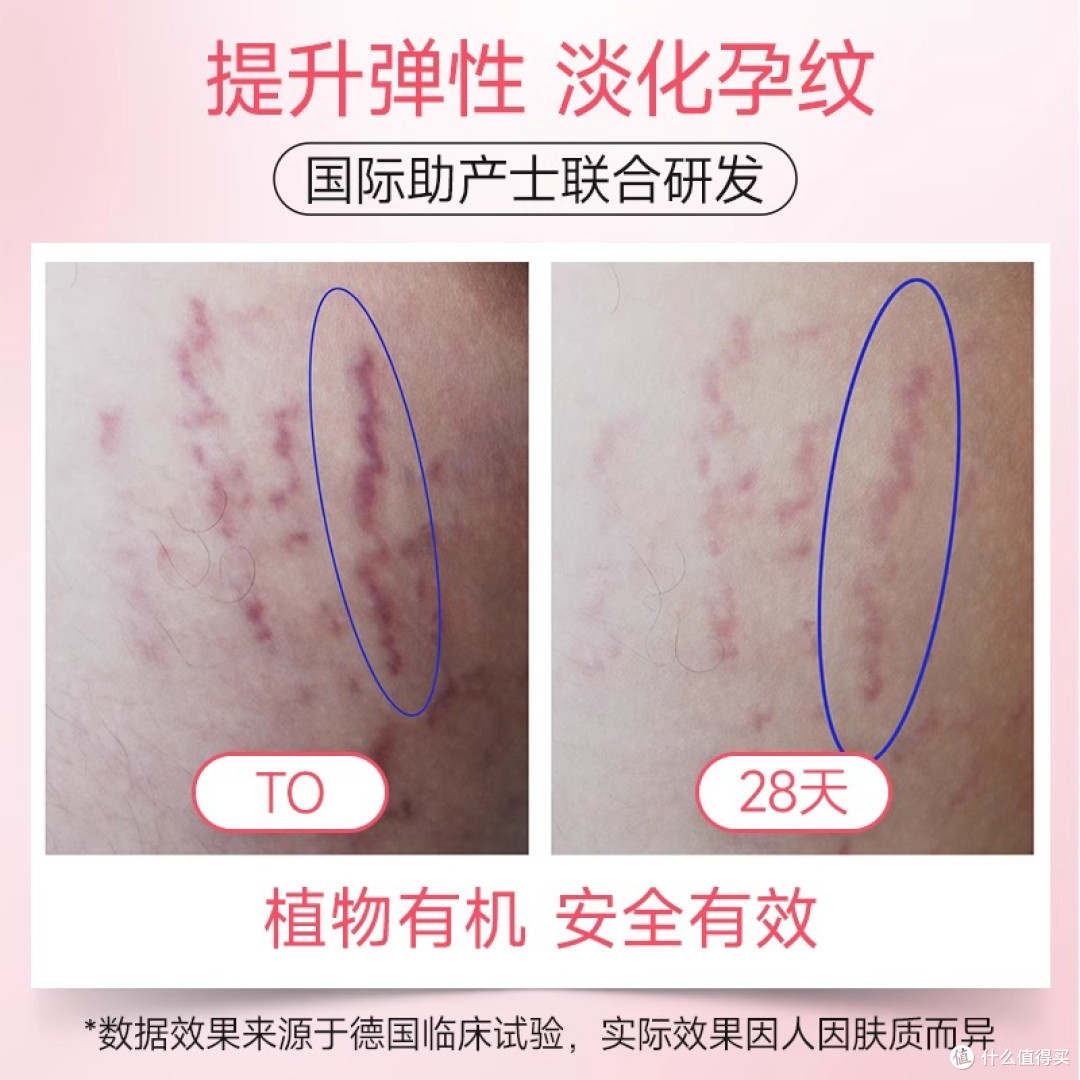 孕期肌肤的温柔铠甲:维蕾德防纹油霜CP深度陪伴