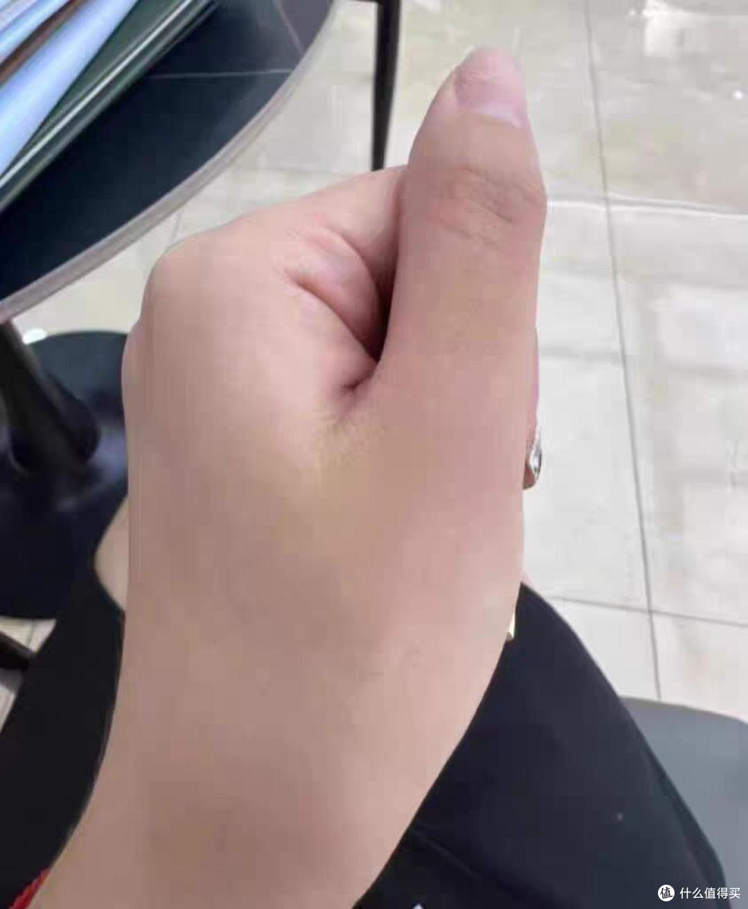 哪种疤痕贴好用？疤痕贴怎么选？