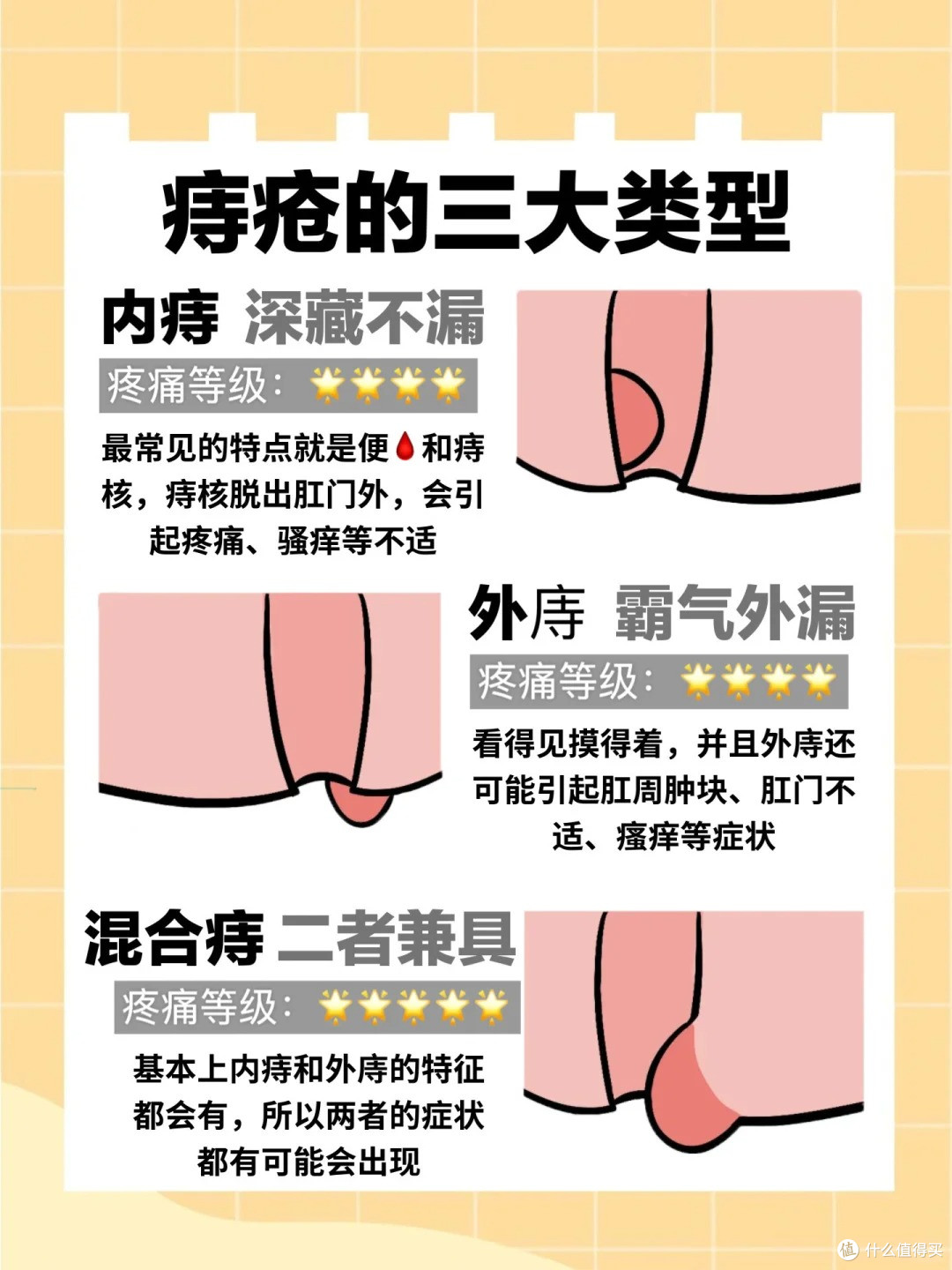 得了痔疮怎么办?痔疮膏这么选就对了?(重度痔疮)