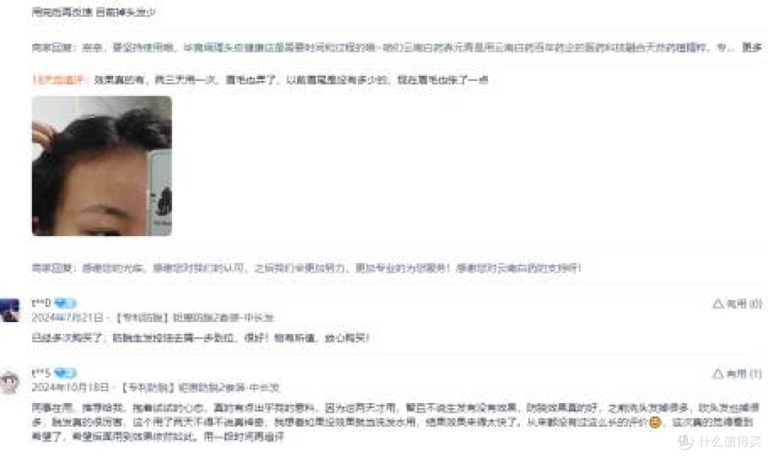 防脱育发洗发水哪个牌子的效果好?养元青用口碑说话