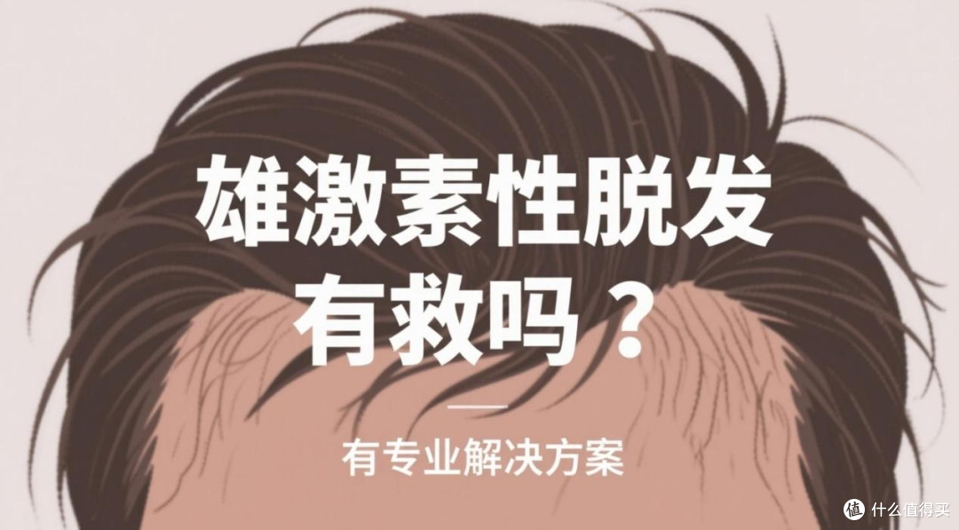 脱发怎么办？雄脱早期信号易忽视！5%米诺地尔泡沫剂成治疗新趋势