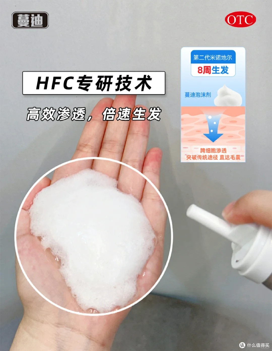 脱发怎么办？雄脱早期信号易忽视！5%米诺地尔泡沫剂成治疗新趋势