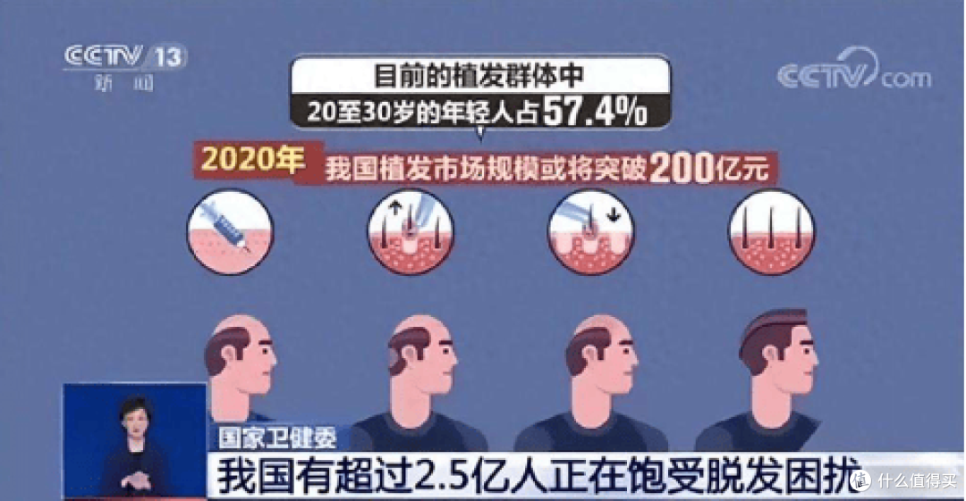 防脱育发洗发水哪个牌子的效果好?什么洗发水增发又防脱发?