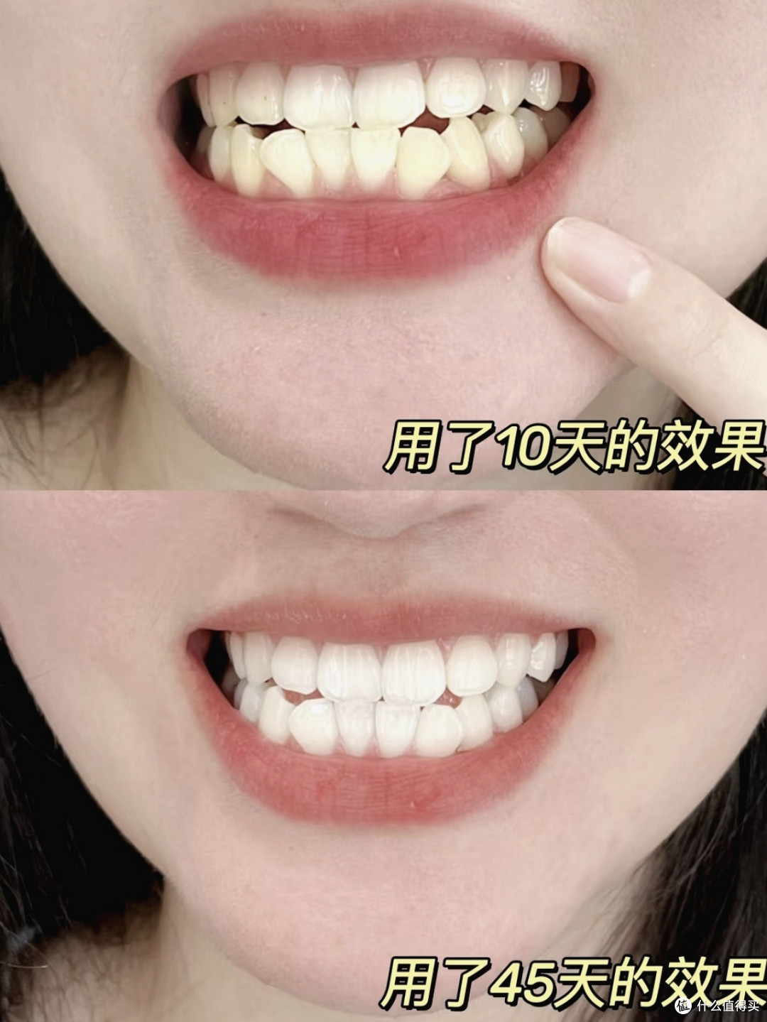坚持正确的护理方法，一口白牙自然来