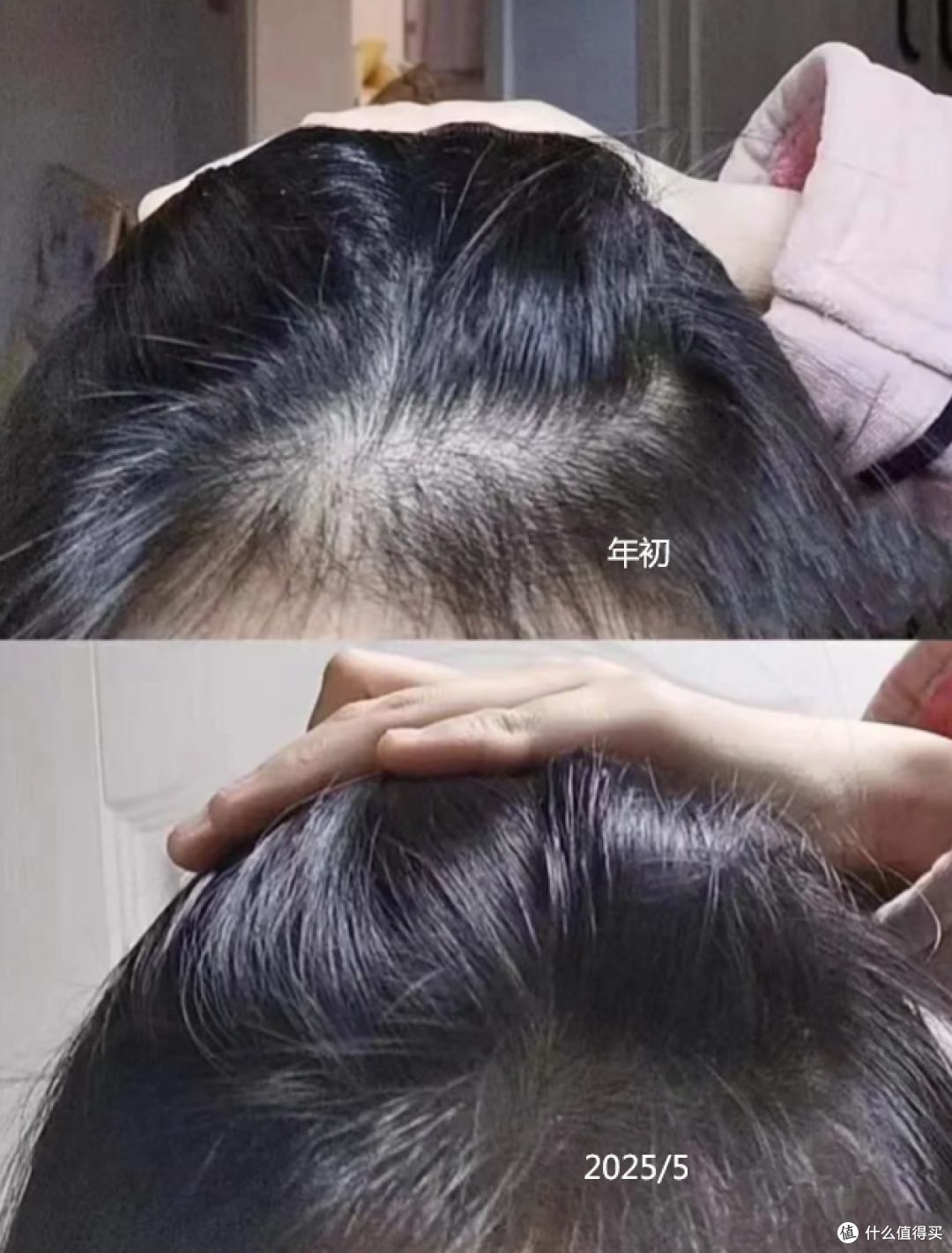 防脱发 生发 增发 密发 哪个牌子好?国药准字号的生发产品榜首