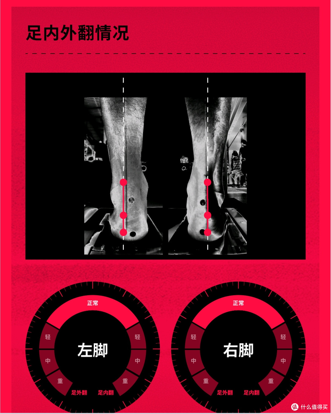 足底筋膜炎：一个月从疼痛难忍到逐步缓解，我做了这些_跑鞋_什么值得买