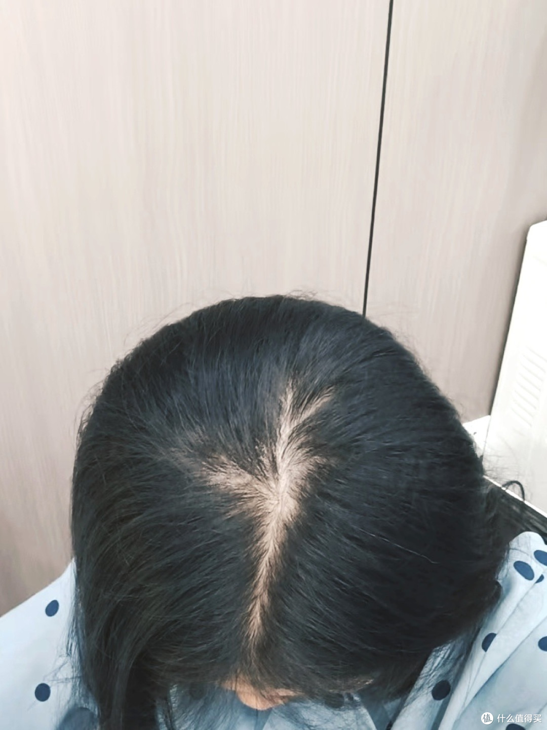 呵护头发的日常小技巧:让脱发困扰渐行渐远