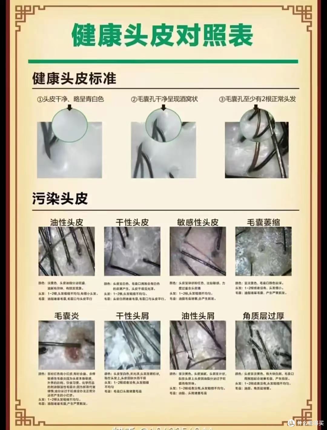 学生党平价育发液推荐,育妍堂黑灵芝多肽精华液亲测有效
