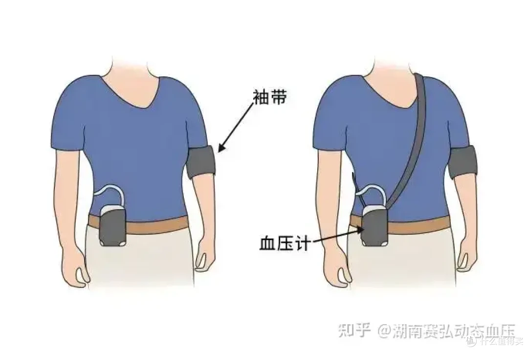 24小时动态血压监测:高血压检测金标准