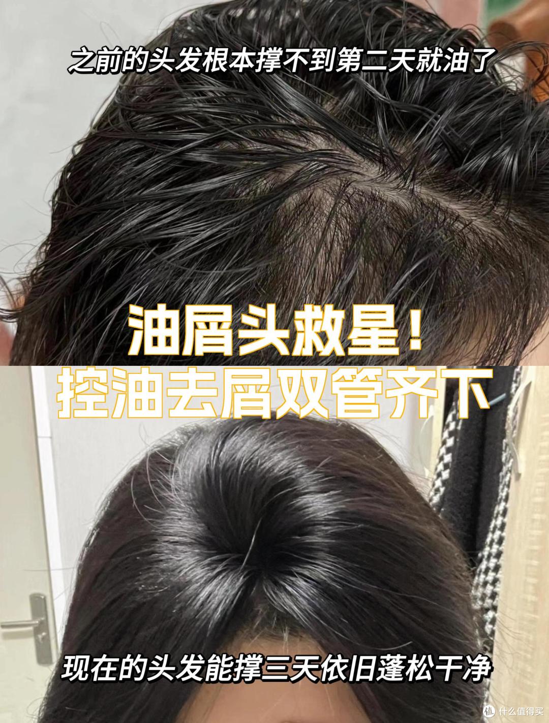 控油洗发水哪个牌子好?2025 实测推荐,长效清爽