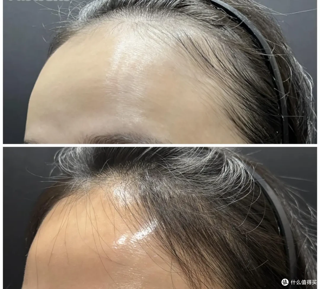 熬夜掉发必看!用它:地漏头发少半,3 月冒新毛