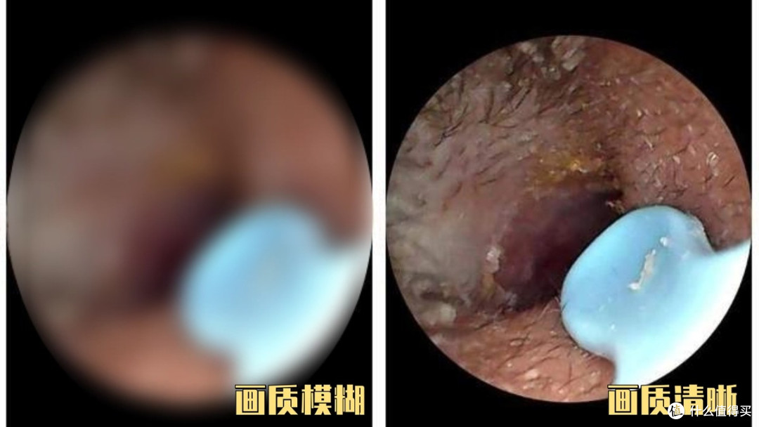 【可视挖耳勺选购攻略】告别选购困难!一文揭秘谁更值得入手!
