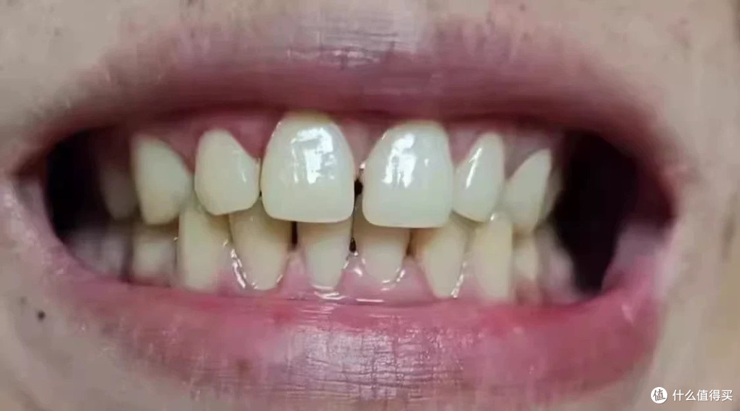 牙缝里的脏东西终于能清干净了!这台洁牙机比洗牙还爽
