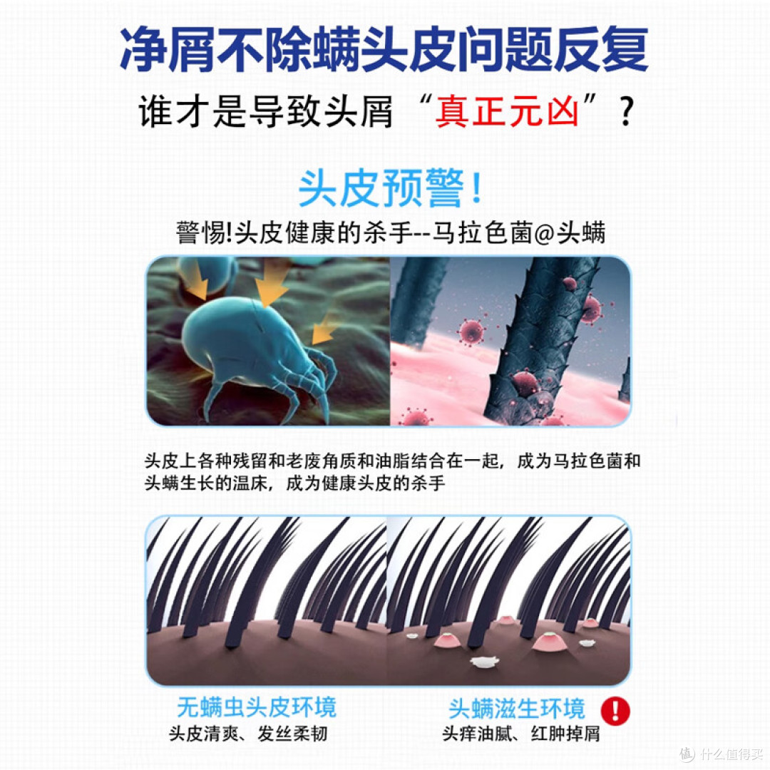 去屑洗发水哪款效果好？和头屑抗战 5 年，终于找到不反复的秘诀