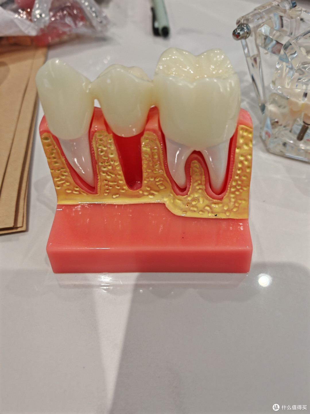 牙齿模型