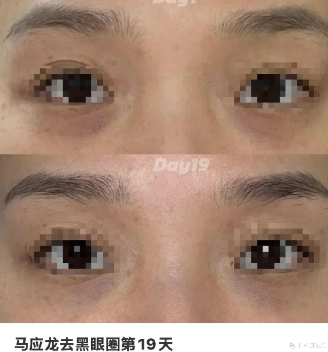 护肤邪修——马应龙:你怎么什么眼都能治?两头都好使!