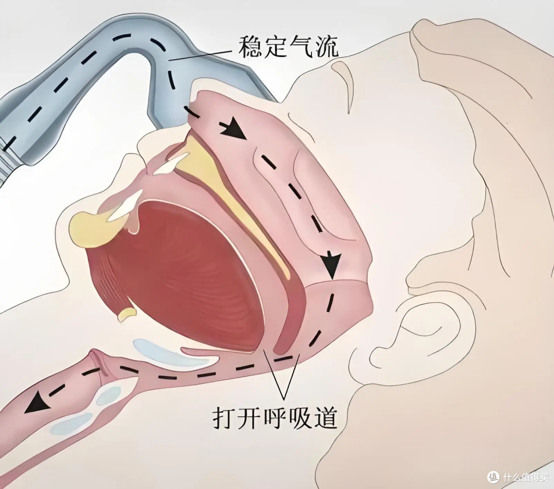2025年家用呼吸机什么牌子好?真实案例告诉你怎么选不踩雷!