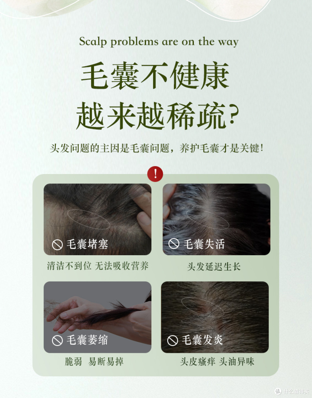 温和不刺激的去屑控油洗发水有哪些?敏感肌适用款