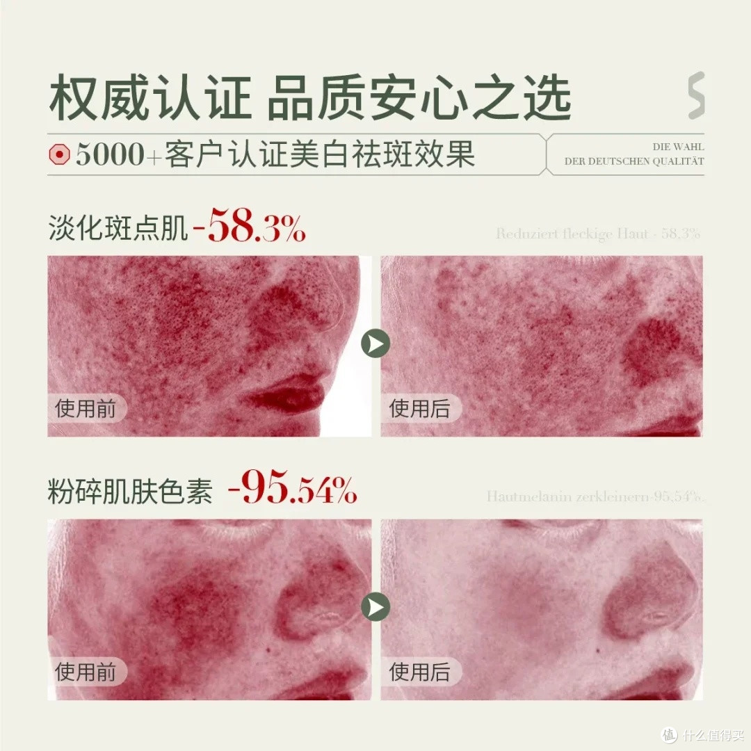 SKISGEM祛斑霜:根源净斑效果显著
