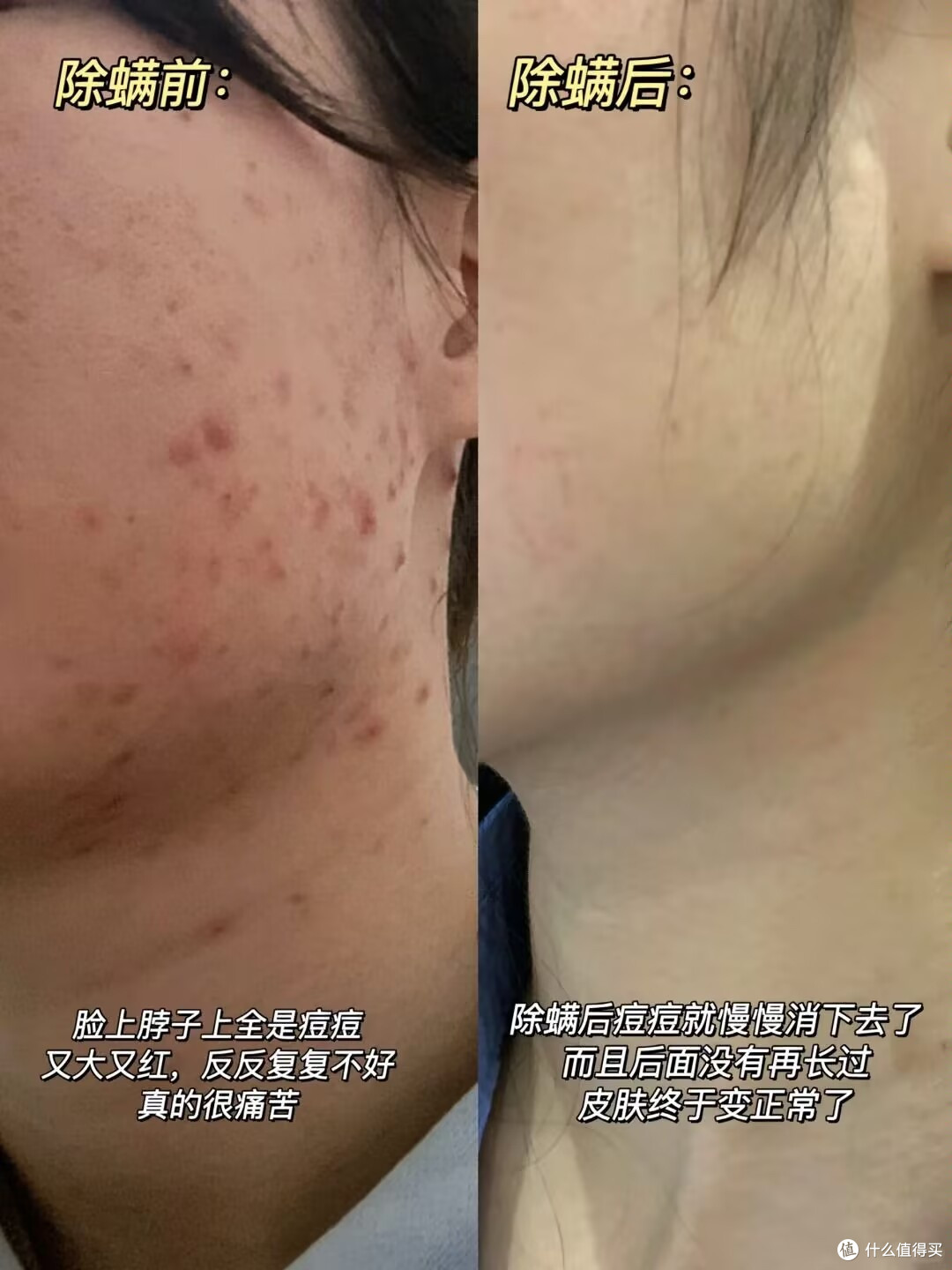 吸尘器 vs 除螨仪：谁的除螨效果更优？友望用专业技术给出答案