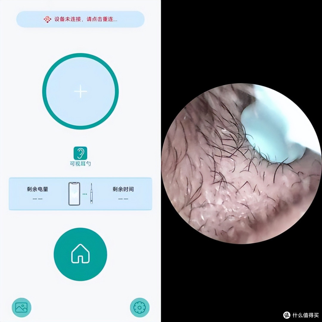 高清可视 + UV 消毒,西圣 Find X让挖耳告别“盲人摸象”