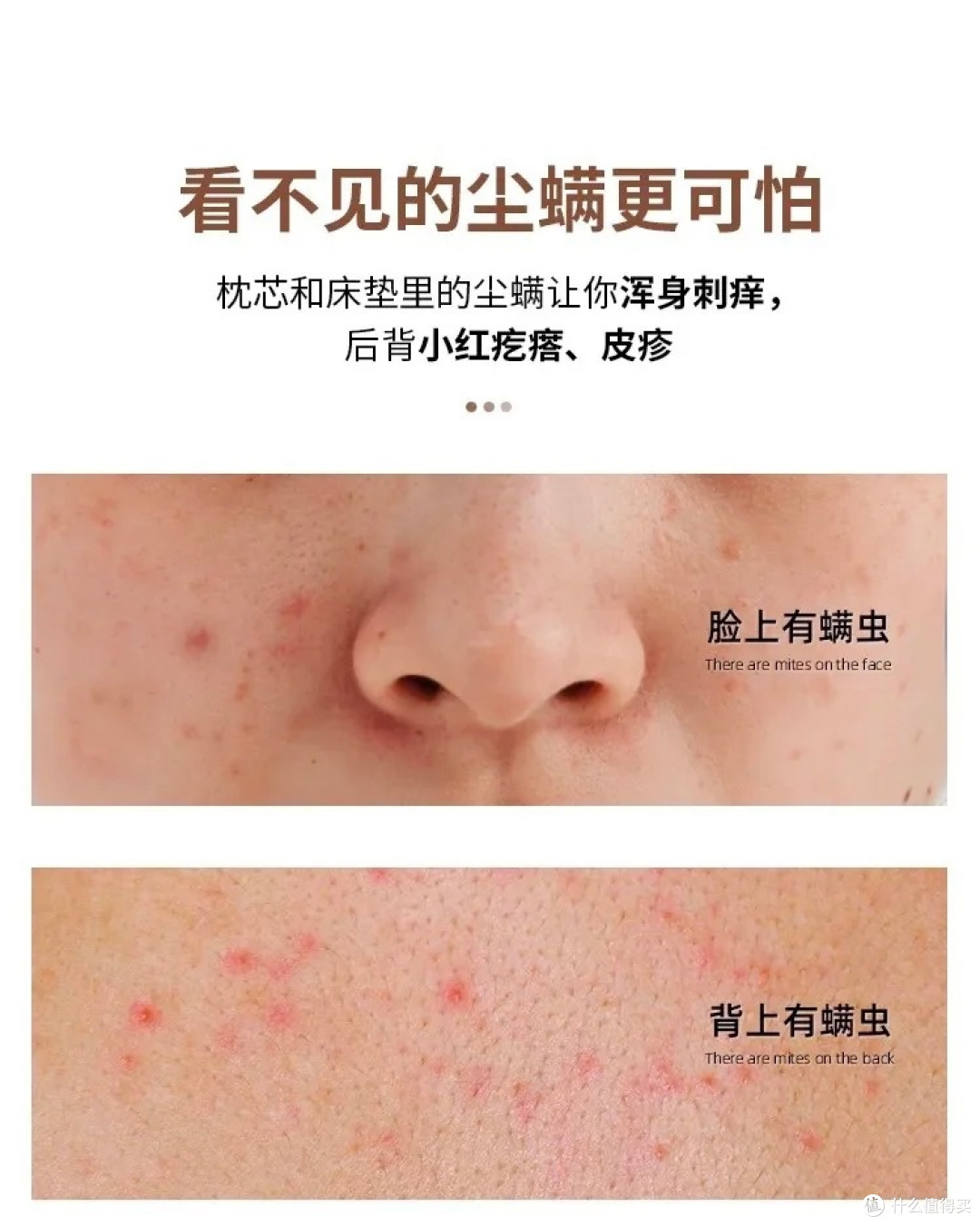护肤品不吸收?罪魁祸首是螨虫!敏感肌除螨的重要性别忽视
